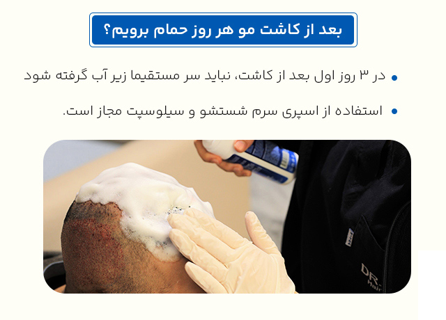 بعد از کاشت مو هر روز حمام برویم؟