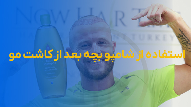 استفاده از شامپو بچه بعد از کاشت مو