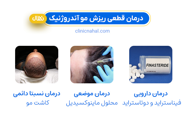 روش های درمان قطعی ریزش مو آندروژنیک
